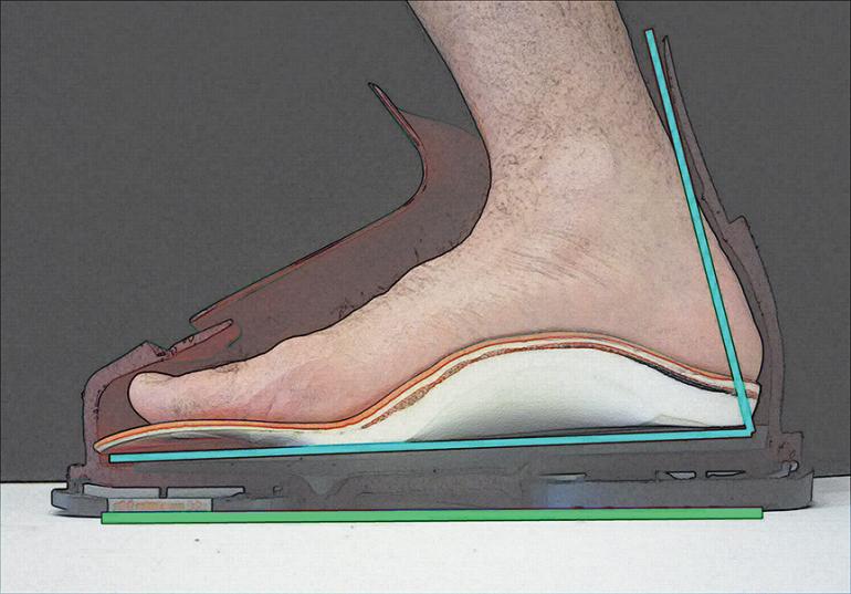 Photo by Lars Scinny Ski Boot Fit, Foot Mechanics